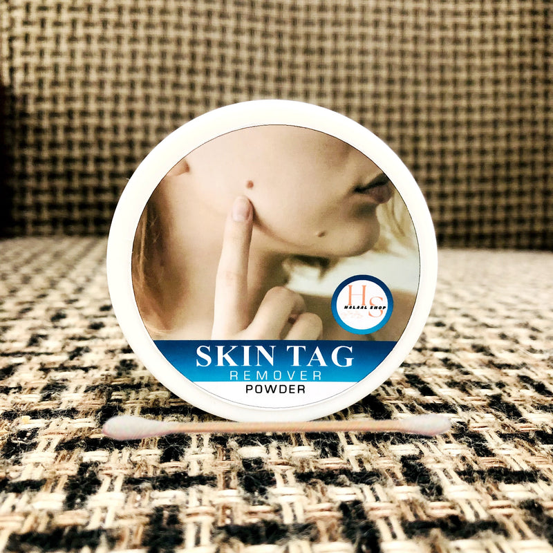 SKIN TAG REMOVER!