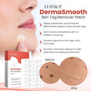 11:11 Sale Two in One DERMA SMOOTH TAG REMOVER + Tag Remover Cream!